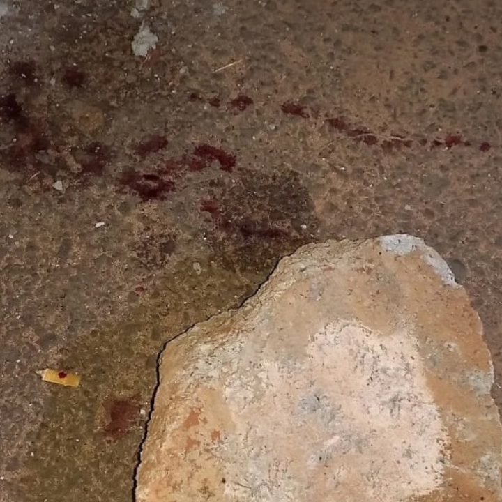 Filho agride pai com pedra de concreto após briga por moto em Três Lagoas