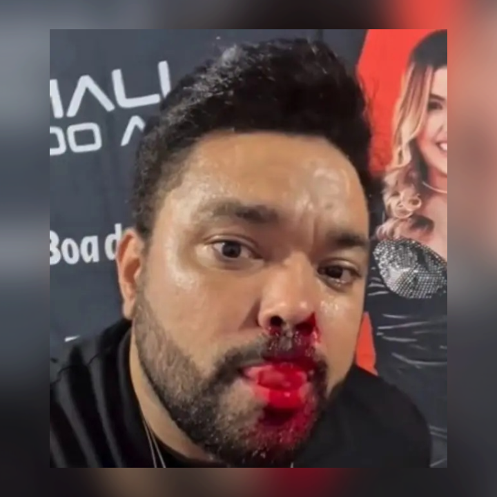 Vídeo: cantor de forró leva lata no rosto durante show e termina com rosto ferido