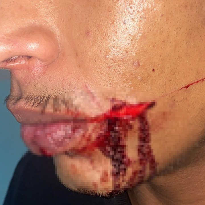 Servente de pedreiro é esfaqueado ao cobrar pagamento em Três Lagoas