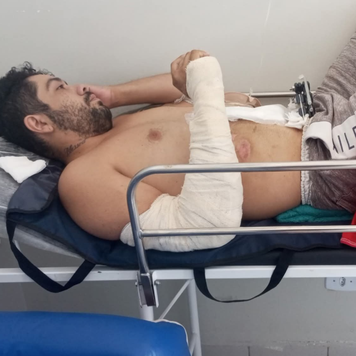 Família denuncia demora por vaga em hospital para paciente com fixador infectado em Campo Grande