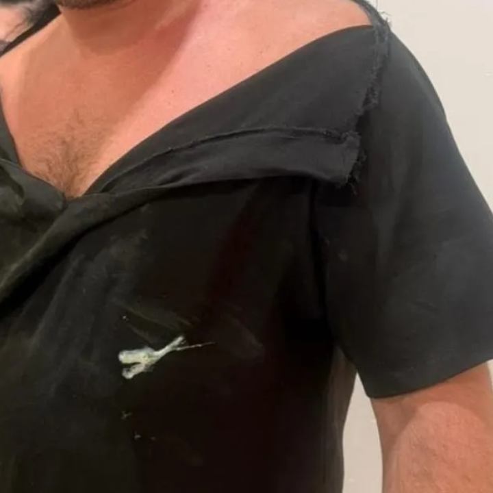 Paciente psiquiátrico agride enfermeiro dentro da UPA de Três Lagoas