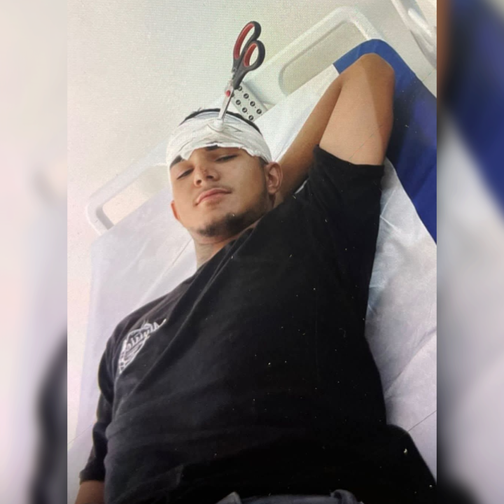 Brincadeira de casal termina em tragédia e jovem fica com tesoura na cabeça